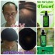 6X120 mL Neo Hair Lotion Root Treatment Nutrients for Loss Hair, Longer Hair