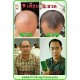 6X120 mL Neo Hair Lotion Root Treatment Nutrients for Loss Hair, Longer Hair
