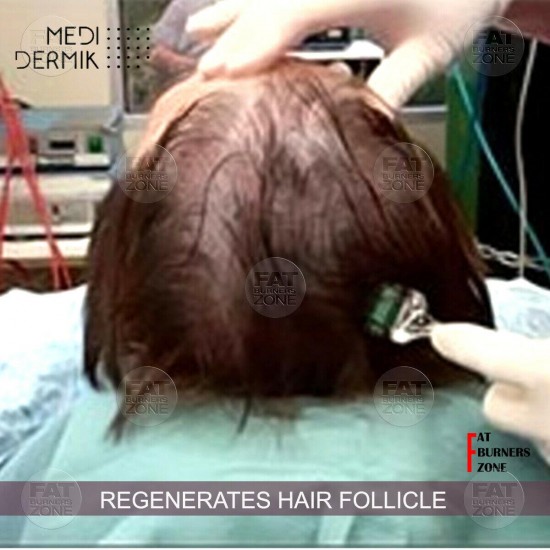 HAIR DERMIK MEDIDERMKI MESOTHERAPY DHT LEVELS GINSENG ARGININE BIOTIN HAIR LOSS