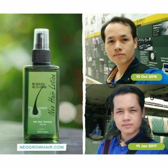 20X120ml Neo Hair Lotion Green Wealth Growth Root Hair Loss Nutrients Treatment