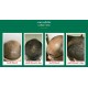 10 bottles 4oz Neo Hair Lotion Growth Root Hair Loss Treatments beards sideburns