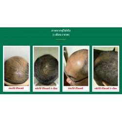 10 X Neo Hair Lotion Growth Root Hair Loss Treatments beards sideburns EXPRESS