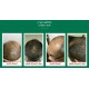 10 X Neo Hair Lotion Growth Root Hair Loss Treatments beards sideburns EXPRESS