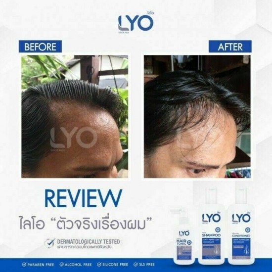 6x LYO Hair Lotion Tonic Shampoo Conditioner Growth Hair Beard Prevent Hair Loss