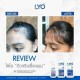 6x LYO Hair Lotion Tonic Shampoo Conditioner Growth Hair Beard Prevent Hair Loss
