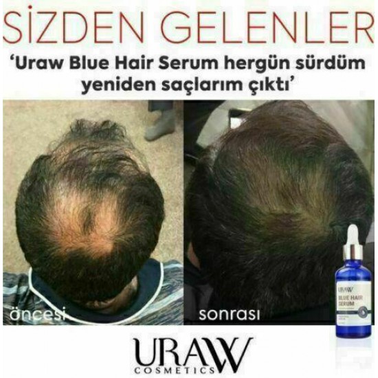 4 x URAW Blue Hair Serum + Dermaroller Set (4+1 Advantage Pack) (NEW DESIGN)