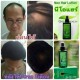 5 X NEW Neo Hair Lotion Hair Loss Treatments Root Nutrients Original 120 ml