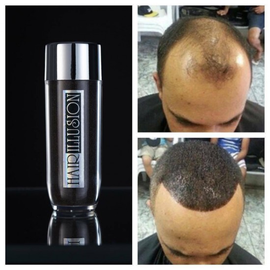 3x HAIR ILLUSION Hair Building Fibers-Unisex Hair Loss Thinning Treatment-BLACK