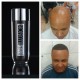 3x HAIR ILLUSION Hair Building Fibers-Unisex Hair Loss Thinning Treatment-BLACK