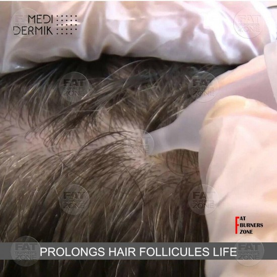 HAIR LOSS MESOTHERAPY TREATMENT HAIR DERMIK GLUTATHIONE ORGANIC SILICIUM