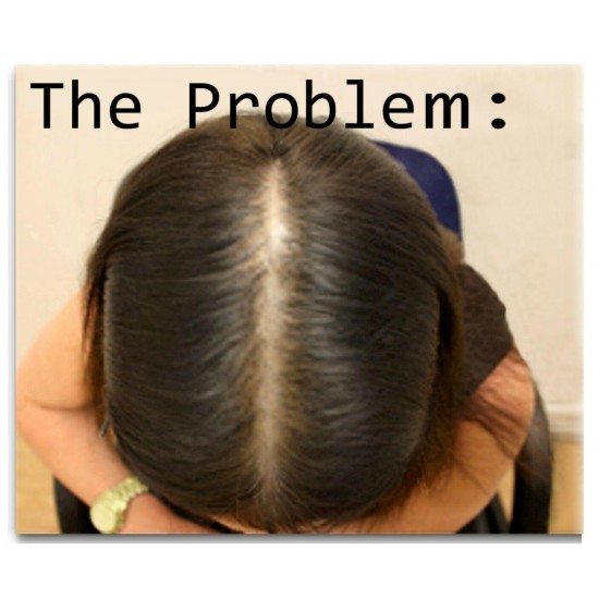 HAIR RENEW 3 COMBO women hair loss regrowth treatment shampoo conditioner dercos