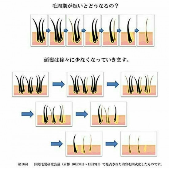 [3 Sets] Advangen BLACK Lexilis Scalp Lotion 100ml Hair Growth Promotion From JP