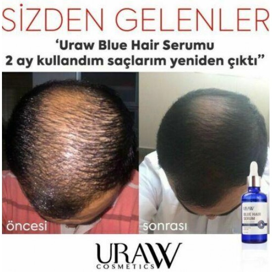 5 x URAW Blue Hair Serum Hair Growth Professional 50 ml (NEW FROM OUR PHARMACY)
