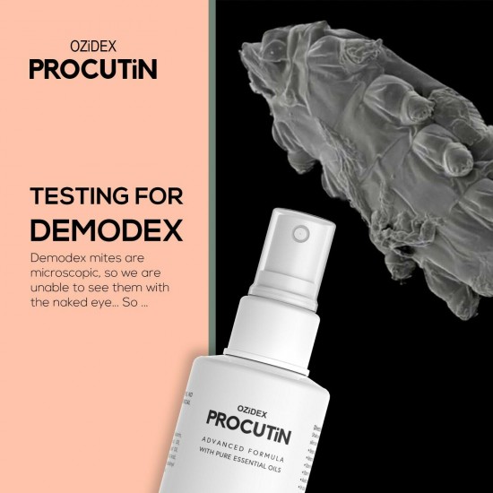Demodex Mites Treatment for Acne Rosacea Dermatitis Blepharitis Itchy Hair loss