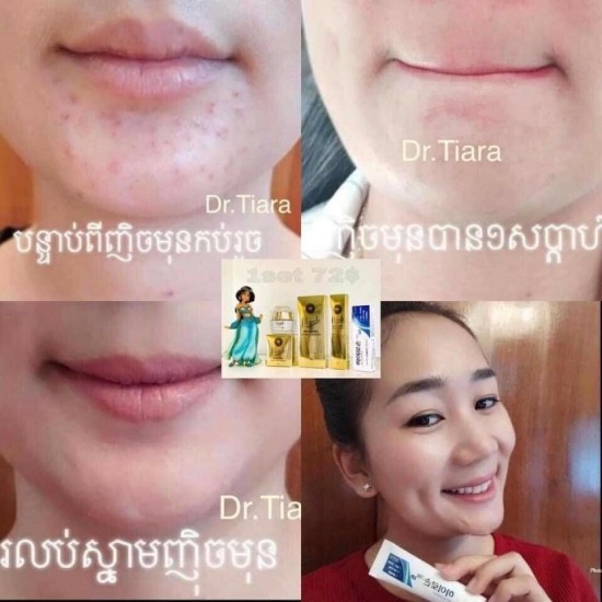 Dr.Tiara Whitening Cream Set