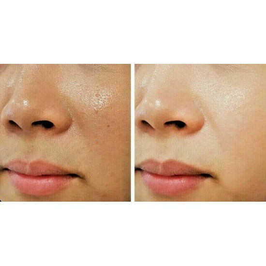 Golden Pearls Beauty Whitening Skin-Remove Pimples/Dark spot/ Original Cream
