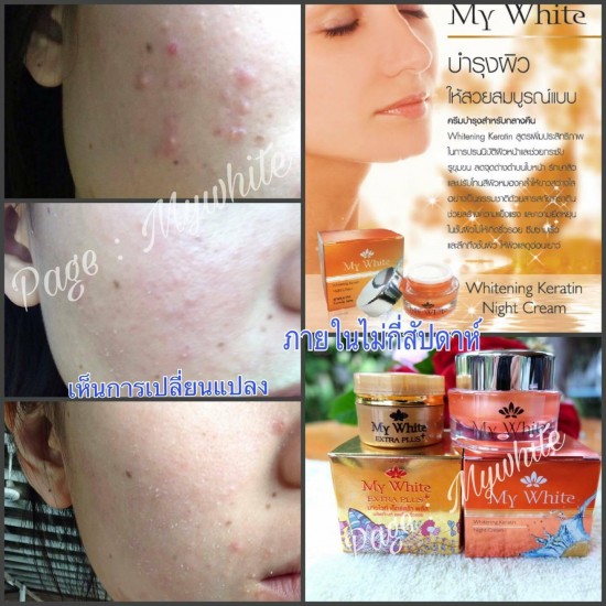 12X MY WHITE WHITENING KERATIN NIGHT CREAM ANTI AGAING ACNE FRECKLES DARK SPOT