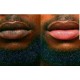 5 X NicoLips dark lips lightening Treatment Lip Balm Scrub FREE DELIVERY