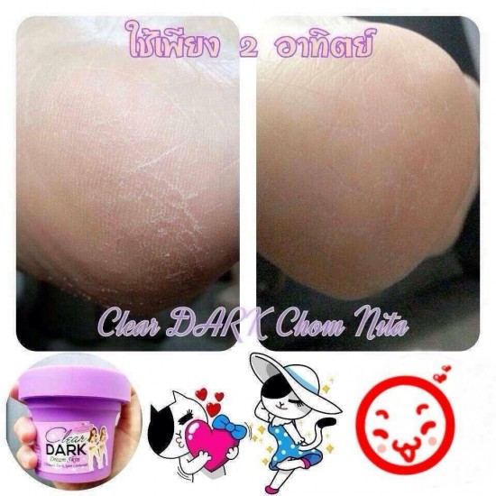 12 X CLEAR DARK BUTT BOTTOM SPOT STRECH MARK REMOVAL WHITENING SOFTEN TREATMENT