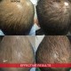 DERMCLAR DERMHAIR  MESOTHERAPY HAIR LOSS PANTHENOL TRACE ELEMENTS ALOPECIA