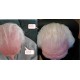 Hairtific Pro 272 Laser Helmet LLLT Hair Restoration