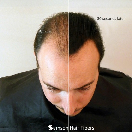 Samson Best Hair Loss Concealer Building Fibers LIGHT BROWN 300g Refill USA