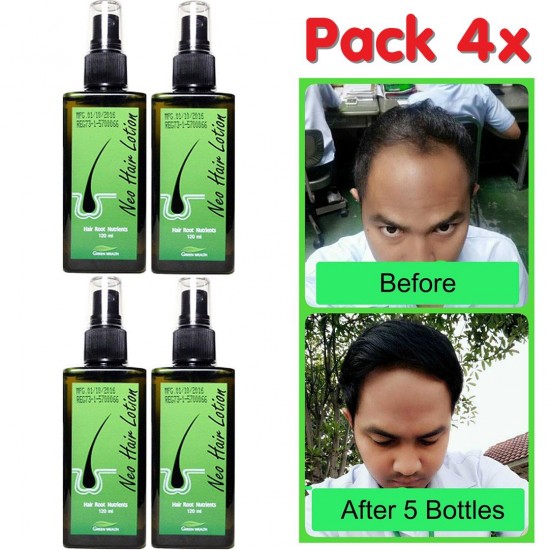 Neo Hair Lotion Hairloss Treatment Spray Authentic Beard Mustache Grow 120ml