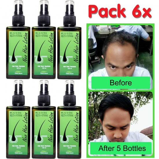 Neo Hair Lotion Hairloss Treatment Spray Authentic Beard Mustache Grow 120ml