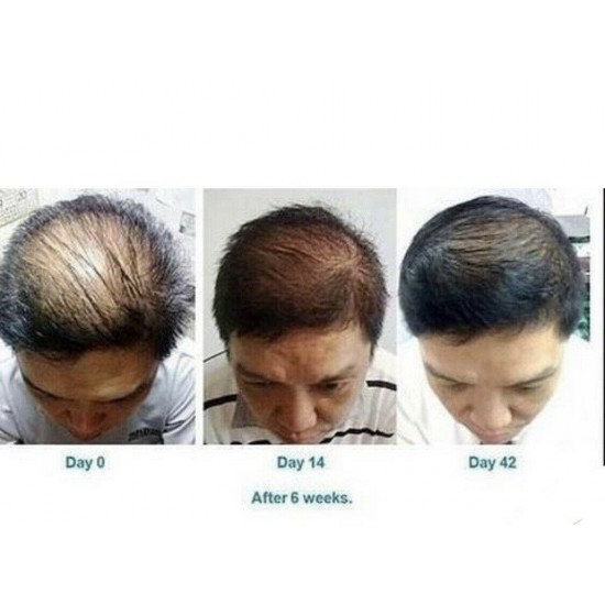 Nu Skin ageLOC Nutriol Scalp & Hair System Shampoo, Conditioner and Hair Serum.