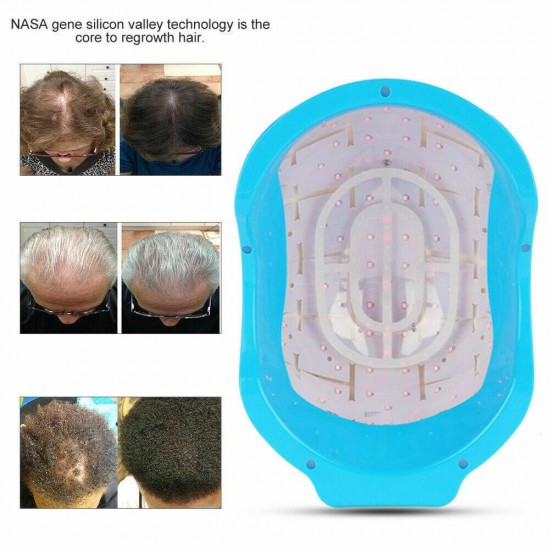 LLLT Laser Cap Hair Loss Treatment Hair Regrowth Therapy Promoter Rechargeable