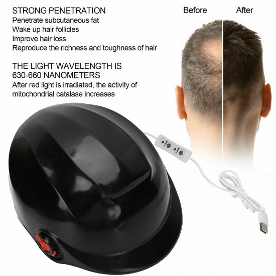 LLLT 280Diode Laser Hair Regrowth Growth Helmet Hair Loss Prevention Cap Therapy