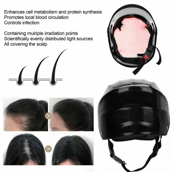 LLLT 280Diode Laser Hair Regrowth Growth Helmet Hair Loss Prevention Cap Therapy