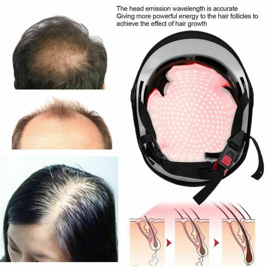 LLLT 280Diode Laser Hair Regrowth Growth Helmet Hair Loss Prevention Cap Therapy