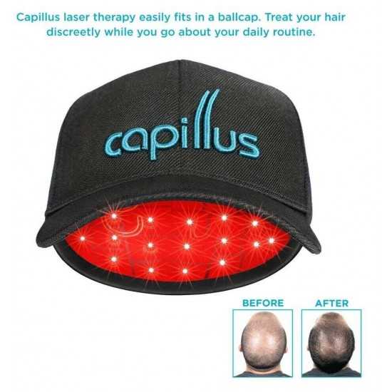 Capillus Ultra Laser Therapy Cap For Hair Regrowth Prevents Hair Loss New