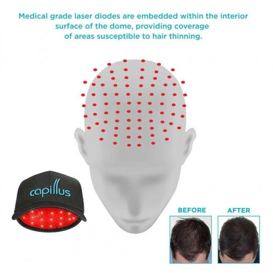 Capillus Ultra Laser Therapy Cap For Hair Regrowth Prevents Hair Loss New