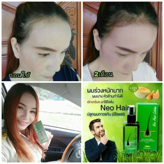 6 x NEO HAIR Lotion Treatment 100% Herb Hair Root Nutrients Green Wealth 120 ml