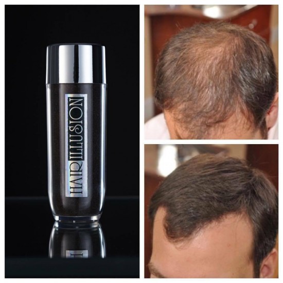 3x HAIR ILLUSION Hair Building Fibers-Unisex Hair Loss Thinning Treatment-BLACK