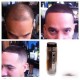 3x HAIR ILLUSION Hair Building Fibers-Unisex Hair Loss Thinning Treatment-BLACK