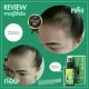 NEW Neo Hair Lotion Hair Loss Treatments Root Nutrients Original 120 ml