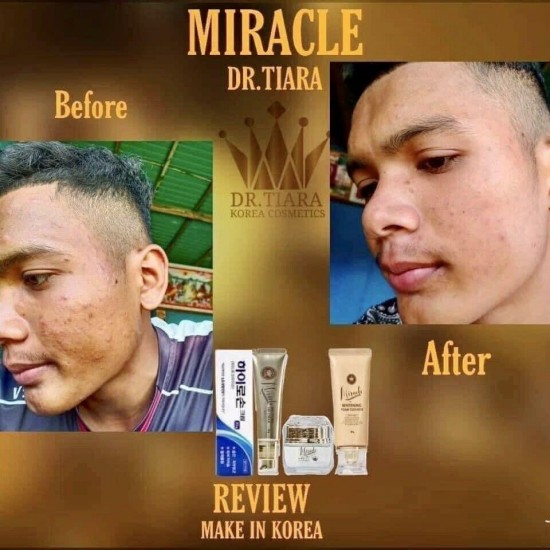 Miracle Dr. Tiara Products 5 Pc