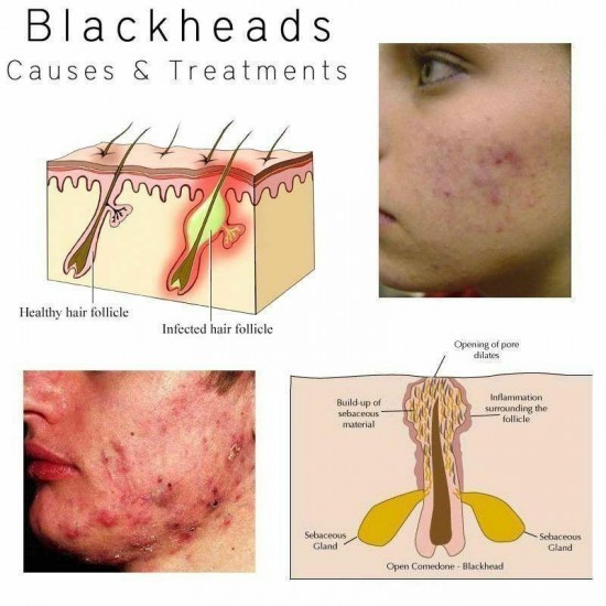 BIOAQUA Charcoal Peel off Blackhead Mask Blackhead Remover Black Mask Wholesale