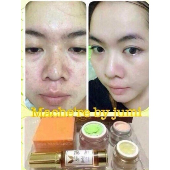 3X Mache're Gold Whitening Cream Acne freckles wrinkles Natural Premium skin