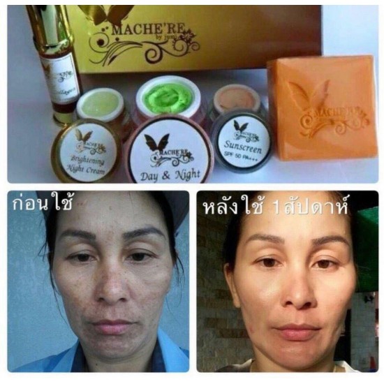 3X Mache're Gold Whitening Cream Acne freckles wrinkles Natural Premium skin