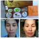 3X Mache're Gold Whitening Cream Acne freckles wrinkles Natural Premium skin