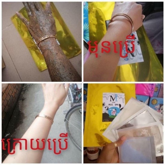 10 Packages DW Gold Peel Spa ស្បាគោកញ្ចប់មាស 10 កញ្ចប់