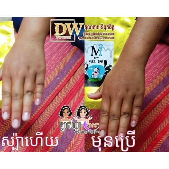 10 Packages DW Gold Peel Spa ស្បាគោកញ្ចប់មាស 10 កញ្ចប់