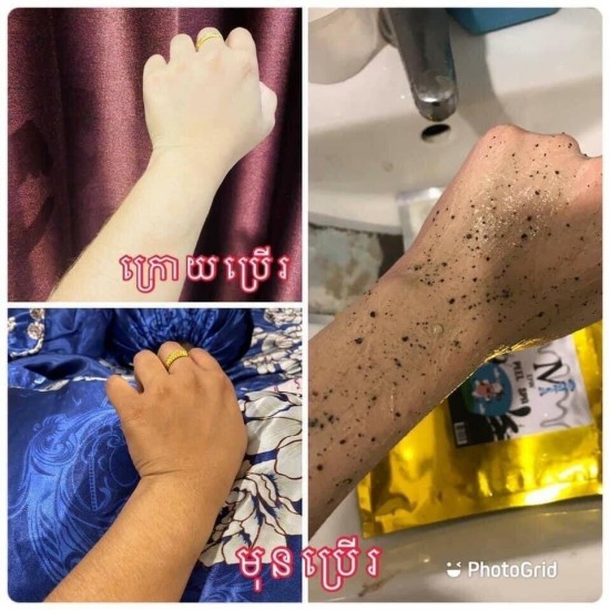 10 Packages DW Gold Peel Spa ស្បាគោកញ្ចប់មាស 10 កញ្ចប់