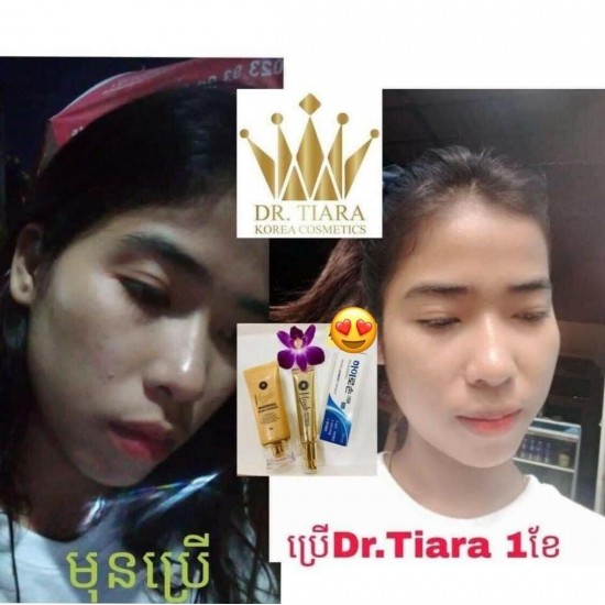 Dr.Tiara Whitening Cream Set