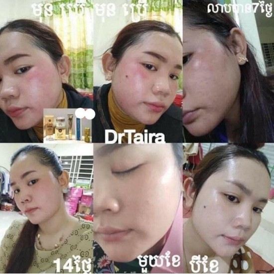 Dr.Tiara Whitening Cream Set