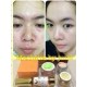 Mache're Gold Whitening Cream Acne freckles wrinkles Natural Premium Big Set